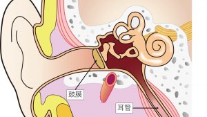 妊娠中に多い耳管開放症 南新宿クリニック 耳鼻科 小児科