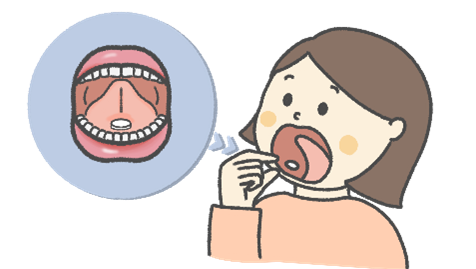 舌下免疫療法